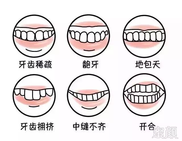 https://img.miyanlife.com/mnt/timg/180804/1129415C5-7.jpg