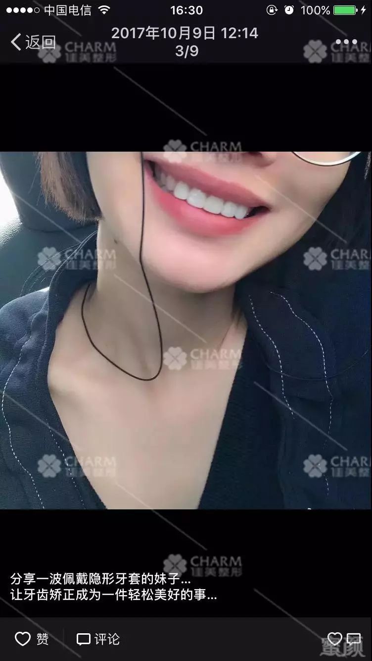 https://img.miyanlife.com/mnt/timg/180804/11294B130-9.jpg