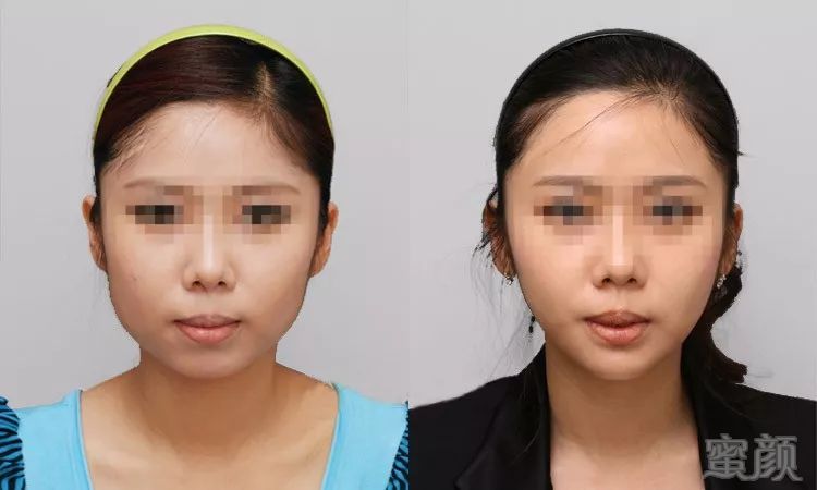 https://img.miyanlife.com/mnt/timg/180804/112Q35425-6.jpg