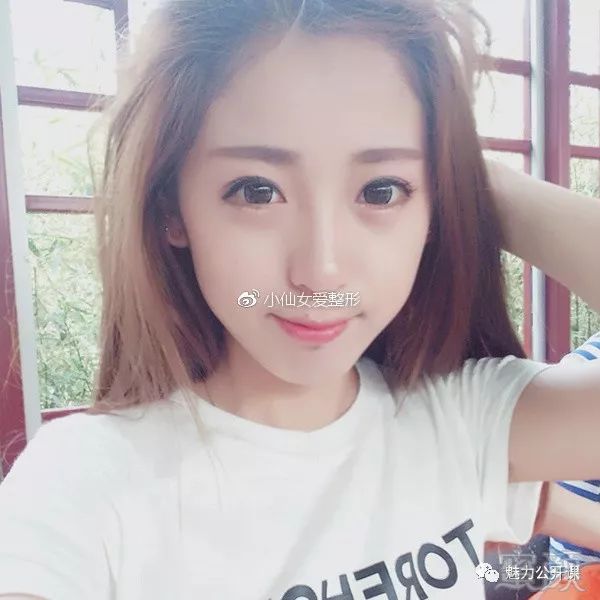 https://img.miyanlife.com/mnt/timg/180804/11352K4W-2.jpg