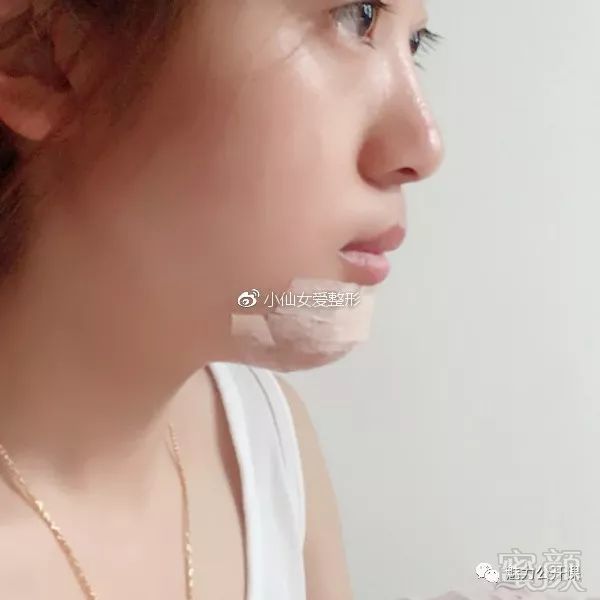 https://img.miyanlife.com/mnt/timg/180804/113530J32-8.jpg
