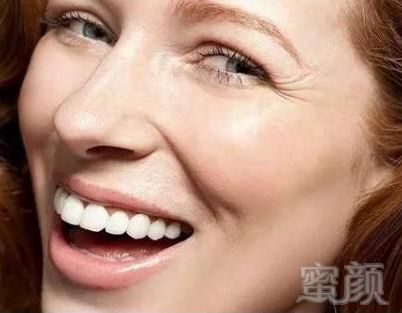https://img.miyanlife.com/mnt/timg/180804/1136091528-3.jpg