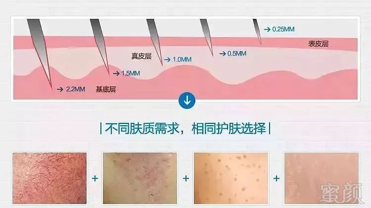 https://img.miyanlife.com/mnt/timg/180804/113H92622-4.jpg