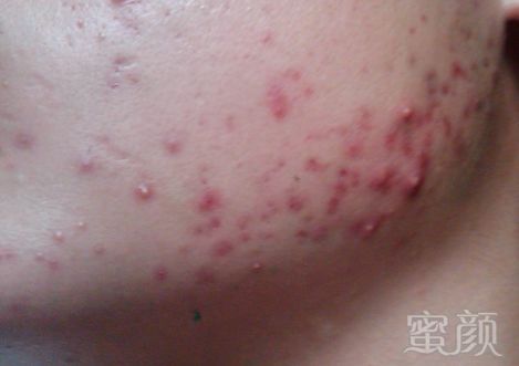 https://img.miyanlife.com/mnt/timg/180804/113HG352-0.jpg
