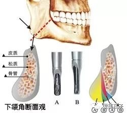 https://img.miyanlife.com/mnt/timg/180804/114S06325-0.jpg