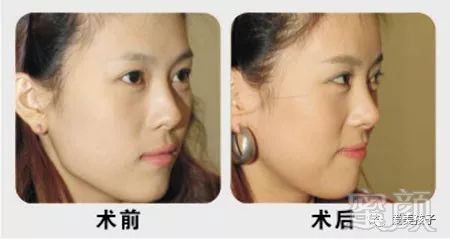 https://img.miyanlife.com/mnt/timg/180804/114S1L15-1.jpg