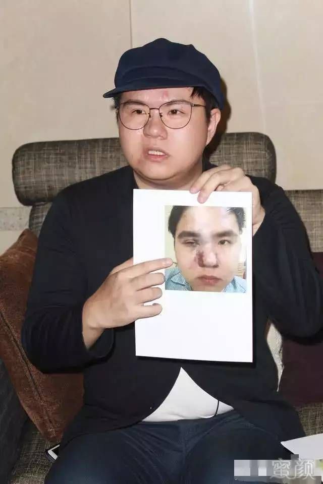 https://img.miyanlife.com/mnt/timg/180804/1155335c0-5.jpg