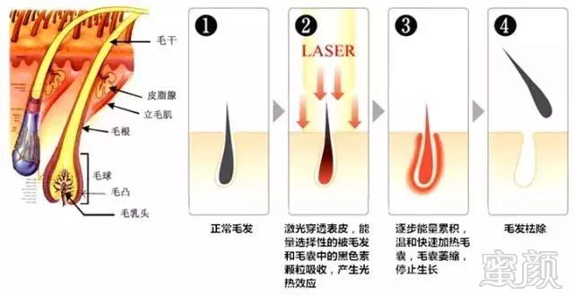 案例图片