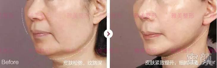 https://img.miyanlife.com/mnt/timg/180804/120H24O4-5.jpg