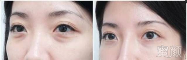 https://img.miyanlife.com/mnt/timg/180804/1211395R6-14.jpg