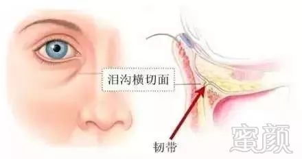 https://img.miyanlife.com/mnt/timg/180804/12113Ic5-3.jpg