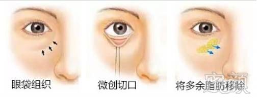 https://img.miyanlife.com/mnt/timg/180804/12113R1Y-7.jpg