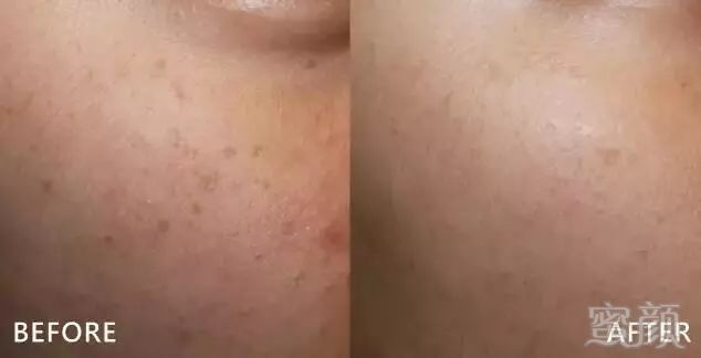 https://img.miyanlife.com/mnt/timg/180804/122KHY1-7.jpg