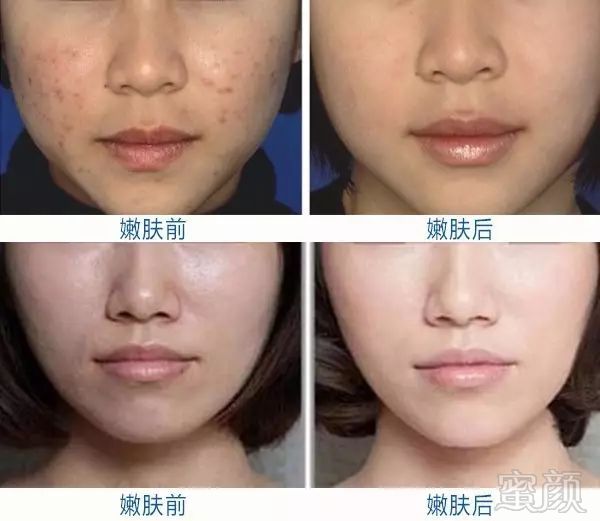 https://img.miyanlife.com/mnt/timg/180804/122KMX8-9.jpg