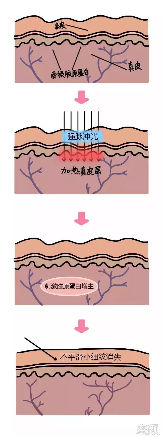 https://img.miyanlife.com/mnt/timg/180804/122QU0c-2.jpg