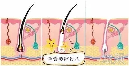 https://img.miyanlife.com/mnt/timg/180805/1135522238-5.jpg