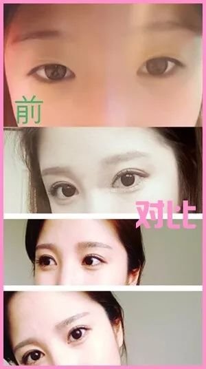 https://img.miyanlife.com/mnt/timg/180805/113KI1F-9.jpg