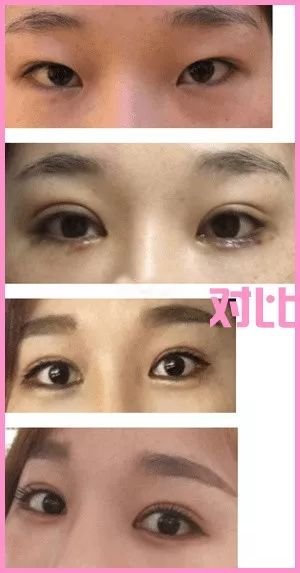 https://img.miyanlife.com/mnt/timg/180805/113KL127-7.jpg
