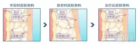 https://img.miyanlife.com/mnt/timg/180805/1206014028-4.jpg