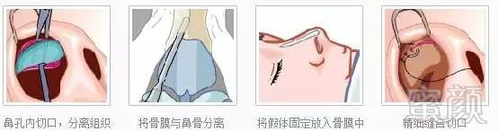 https://img.miyanlife.com/mnt/timg/180805/12094L637-8.jpg