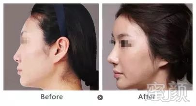 https://img.miyanlife.com/mnt/timg/180805/12094MD4-10.jpg