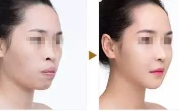 https://img.miyanlife.com/mnt/timg/180805/12094ME1-9.jpg