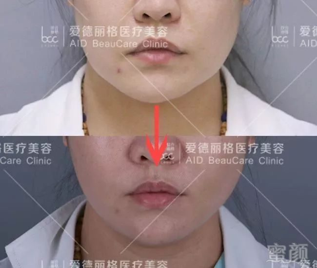 https://img.miyanlife.com/mnt/timg/180805/120I13L9-1.jpg