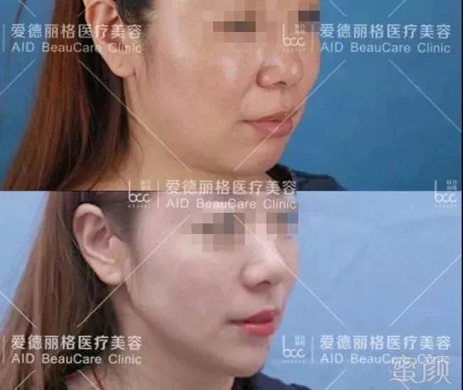 https://img.miyanlife.com/mnt/timg/180805/120I22405-3.jpg