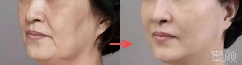 https://img.miyanlife.com/mnt/timg/180805/120I2G59-4.jpg
