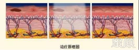 https://img.miyanlife.com/mnt/timg/180805/120K62G8-1.jpg
