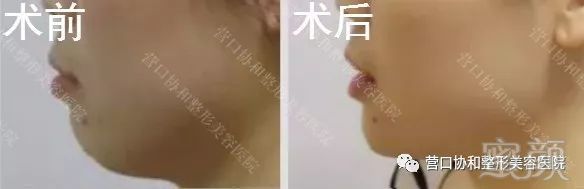 https://img.miyanlife.com/mnt/timg/180805/1219522918-7.jpg