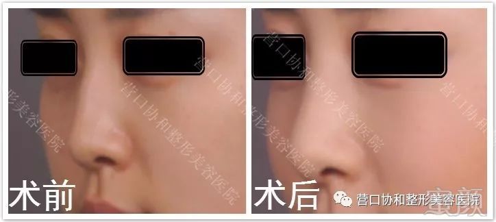 https://img.miyanlife.com/mnt/timg/180805/1219526446-6.jpg