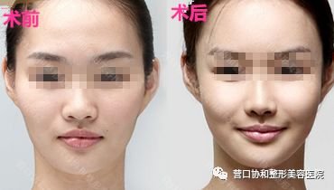 https://img.miyanlife.com/mnt/timg/180805/12195319E-9.jpg