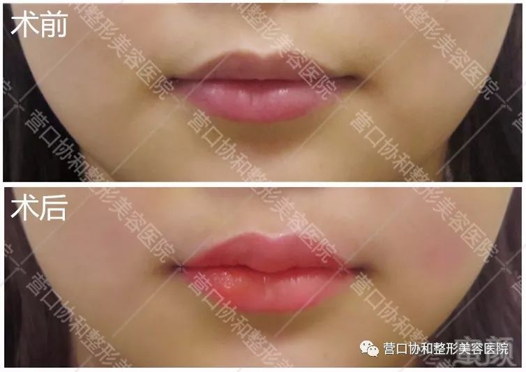 https://img.miyanlife.com/mnt/timg/180805/1219534A1-8.jpg