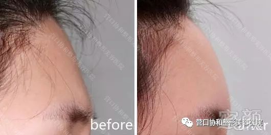 https://img.miyanlife.com/mnt/timg/180805/1219542501-10.jpg