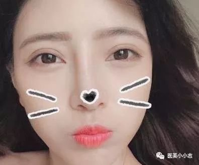 https://img.miyanlife.com/mnt/timg/180805/121R64145-3.jpg