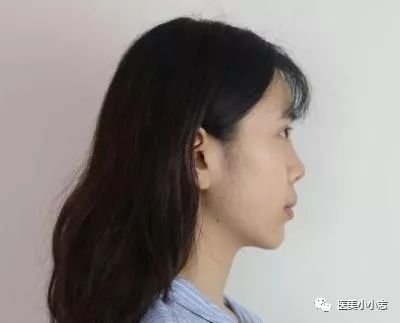 https://img.miyanlife.com/mnt/timg/180805/121RB538-1.jpg