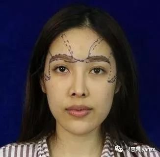 https://img.miyanlife.com/mnt/timg/180805/1220545158-0.jpg
