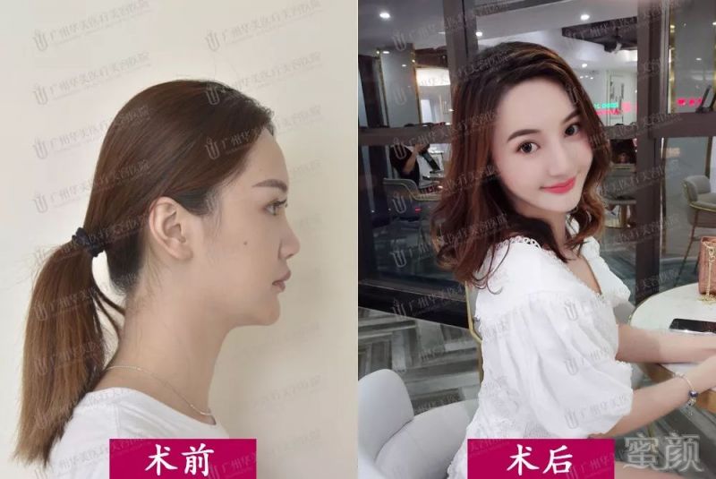 https://img.miyanlife.com/mnt/timg/180805/12243H534-5.jpg