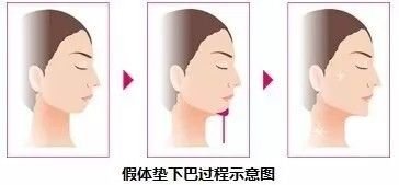 https://img.miyanlife.com/mnt/timg/180805/12243M930-4.jpg