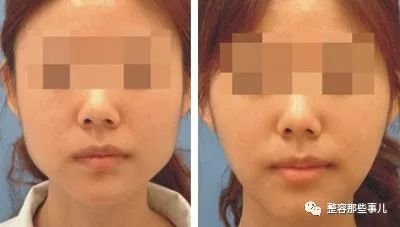 https://img.miyanlife.com/mnt/timg/180805/122F03E2-3.jpg