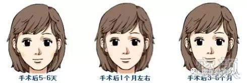 https://img.miyanlife.com/mnt/timg/180805/122H01344-2.jpg