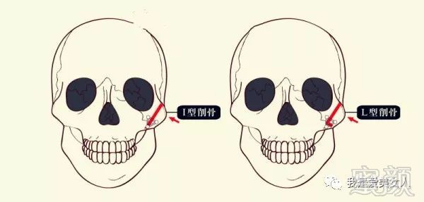 https://img.miyanlife.com/mnt/timg/180805/122H03554-1.jpg