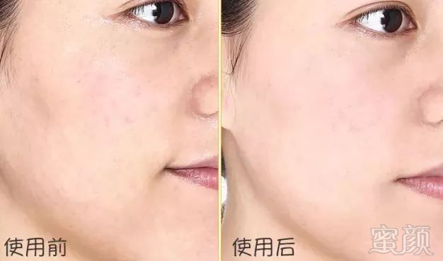 https://img.miyanlife.com/mnt/timg/180805/12534K603-4.jpg
