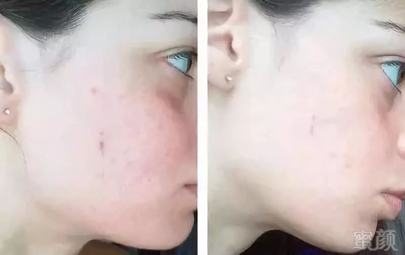 https://img.miyanlife.com/mnt/timg/180805/12534Ma1-5.jpg