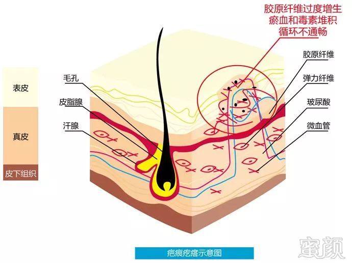 案例图片