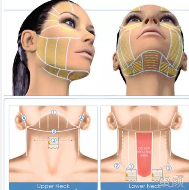 https://img.miyanlife.com/mnt/timg/180805/1310015Y7-5.jpg
