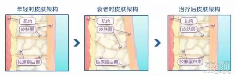 https://img.miyanlife.com/mnt/timg/180805/1310023302-7.jpg