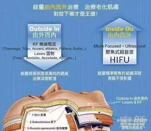 https://img.miyanlife.com/mnt/timg/180805/131003HX-11.jpg