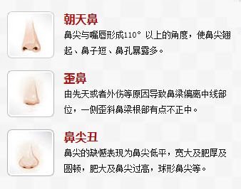 https://img.miyanlife.com/mnt/timg/180805/13203VK4-0.jpg